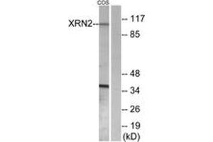Western blot analysis of extracts from COS7 cells, using XRN2 Antibody. (Renin-2 抗体  (AA 81-130))
