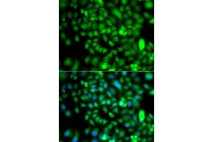 Immunofluorescence analysis of  cells using CSRP2BP antibody (ABIN6127664, ABIN6139138, ABIN6139139 and ABIN6223242). (CSRP2BP 抗体  (AA 523-782))