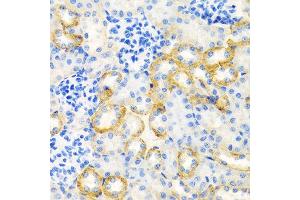 Immunohistochemistry of paraffin-embedded rat kidney using STC1 antibody at dilution of 1:100 (40x lens). (Stanniocalcin 1 抗体)