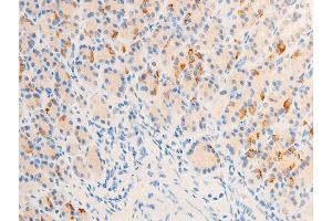 Immunohistochemistry (IHC) image for anti-Receptor tyrosine-protein kinase erbB-2 (ErbB2/Her2) (pTyr877) antibody (ABIN6256054)