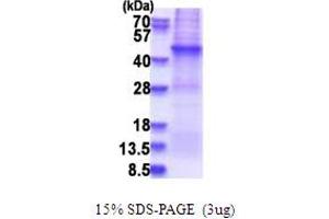 AFAP Protein (AA 250-590) (His tag)