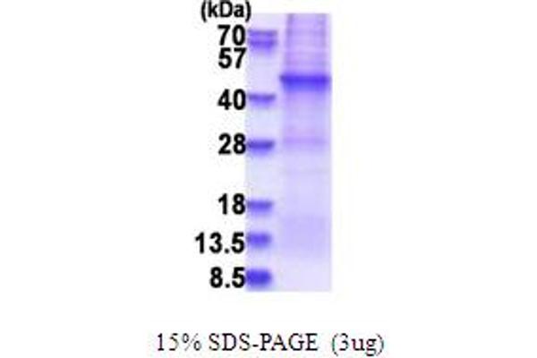 AFAP Protein (AA 250-590) (His tag)