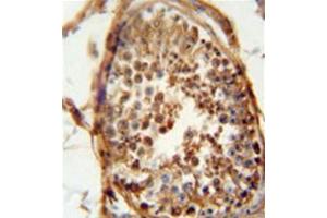 Immunohistochemistry (Paraffin-embedded Sections) (IHC (p)) image for anti-DnaJ (Hsp40) Homolog, Subfamily B, Member 13 (DNAJB13) (AA 179-209), (Middle Region) antibody (ABIN951942)
