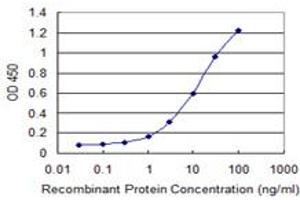 Detection limit for recombinant GST tagged RNF133 is 0. (RNF133 抗体  (AA 277-376))