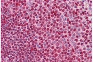 Human Spleen: Formalin-Fixed, Paraffin-Embedded (FFPE) (CUX1 抗体  (AA 521-621))