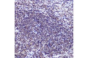 Immunohistochemistry (IHC) image for anti-Ubiquitin Specific Peptidase 39 (USP39) antibody (ABIN7271160)