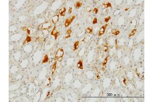 Immunoperoxidase of monoclonal antibody to SERPING1 on formalin-fixed paraffin-embedded human kidney.