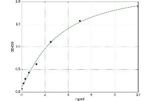 A typical standard curve (Stathmin 1 ELISA 试剂盒)