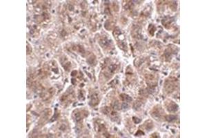 Immunohistochemistry of TREX2 in human liver tissue with this product at 2. (TREX2 抗体  (C-Term))