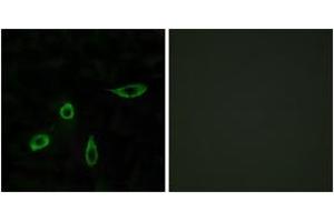 Immunofluorescence analysis of LOVO cells, using EDG4 Antibody. (EDG4 抗体  (AA 290-339))