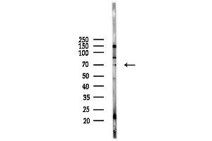 Western blot analysis of lysates from  cells(starvation,24h treatment), using M Antibody at 1/1000 dilution. (MTA3 抗体  (Internal Region))