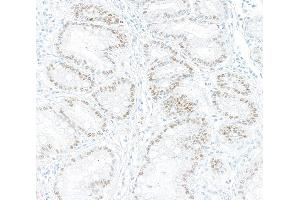 Immunohistochemistry (IHC) image for anti-Kruppel-Like Factor 4 (Gut) (KLF4) (AA 75-125) antibody (ABIN7795639) (Recombinant KLF4 抗体  (AA 75-125))