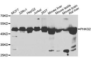 Western blot analysis of extracts of various cell lines, using PHKG2 antibody. (PHKG2 抗体  (AA 237-406))