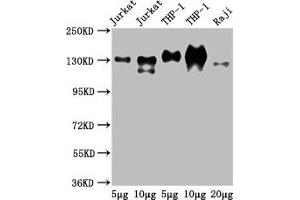Western Blot Positive WB detected in: Jurkat whole cell lysate, THP-1 whole cell lysate, Raji whole cell lysate All lanes: CD31 antibody at 2. (CD31 抗体  (AA 28-315))