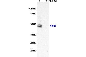 Lane 1: rat liver lysates Lane 2: rat brain lysates probed with Anti Hepatitis C Virus NS5a Polyclonal Antibody, Unconjugated (ABIN1385124) at 1:200 in 4 °C. (HCV NS5a 抗体)