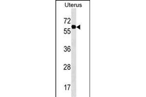 PGM3 Antibody (Center) (ABIN1538149 and ABIN2850274) western blot analysis in Uterus tissue lysates (35 μg/lane). (Phosphoglucomutase 3 抗体  (AA 237-263))