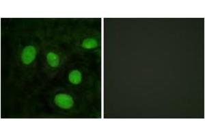 Immunofluorescence analysis of HeLa cells, using Histone H1 (Ab-25) Antibody. (Histone H1 抗体  (AA 131-180))