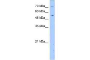 Western Blotting (WB) image for anti-Dihydropyrimidinase (DPYS) antibody (ABIN2462414) (DPYS 抗体)
