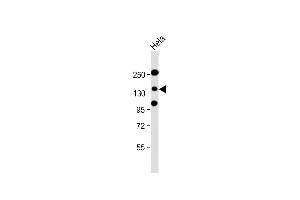 Anti-ZEB2 Antibody (C-term) at 1:2000 dilution + Hela cell nucleus lysate Lysates/proteins at 20 μg per lane. (ZEB2 抗体  (C-Term))