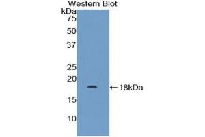 Western blot analysis of recombinant Human MAPKSP1. (MAPKSP1 抗体  (AA 1-124))