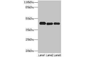 Western blot All lanes: PPME1 antibody at 2 μg/mL Lane 1: A549 whole cell lysate Lane 2: Hela whole cell lysate Lane 3: Mouse brain tissue Secondary Goat polyclonal to rabbit IgG at 1/10000 dilution Predicted band size: 43, 23, 19, 44 kDa Observed band size: 43 kDa (PPME1 抗体  (AA 201-386))
