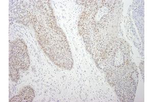 Immunohistochemistry (IHC) image for anti-DEAD (Asp-Glu-Ala-Asp) Box Polypeptide 21 (DDX21) (C-Term) antibody (ABIN7448516) (DDX21 抗体  (C-Term))