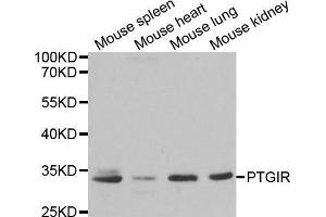 Western blot analysis of extracts of various cell lines, using PTGIR antibody. (Prostacyclin Receptor 抗体  (AA 207-386))