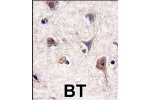 Immunohistochemistry (Paraffin-embedded Sections) (IHC (p)) image for anti-Microtubule-Associated Protein 1 Light Chain 3 alpha (MAP1LC3A) (AA 1-30), (N-Term) antibody (ABIN388464)