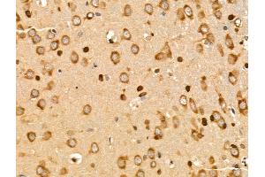 ABIN7094837 and ABIN7098888 at 1/100 staining Rat brain tissue by IHC-P.