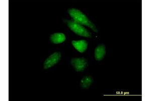 Immunofluorescence of purified MaxPab antibody to PER1 on HeLa cell. (PER1 抗体  (AA 1-1290))