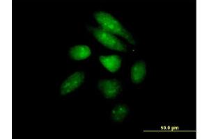 Immunofluorescence of purified MaxPab antibody to PER1 on HeLa cell.