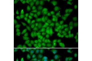 Immunofluorescence analysis of HeLa cells using CDKN2C Polyclonal Antibody (CDKN2C 抗体)