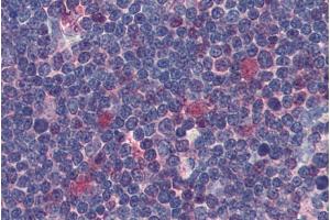 Immunohistochemistry staining of human thymus (paraffin sections) using anti-Cdk1 (clone POH-1). (CDK1 抗体)