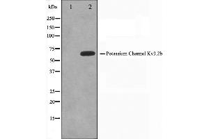 Western blot analysis on HepG2 cell lysate using KCNC2 Antibody,The lane on the left is treated with the antigen-specific peptide. (KCNC2 抗体  (C-Term))