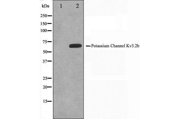 KCNC2 抗体  (C-Term)