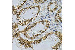 Immunohistochemistry of paraffin-embedded human stomach using SIGMAR1 antibody (ABIN5973191) (40x lens). (SIGMAR1 抗体)