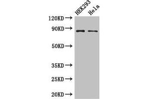 Western Blot Positive WB detected in: HEK293 whole cell lysate, Hela whole cell lysate All lanes: MLH1 antibody at 3 μg/mL Secondary Goat polyclonal to rabbit IgG at 1/50000 dilution Predicted band size: 85, 59, 74 kDa Observed band size: 85 kDa (MLH1 抗体  (AA 350-519))