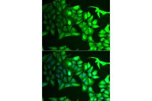 Immunofluorescence analysis of HeLa cell using AIPL1 antibody.