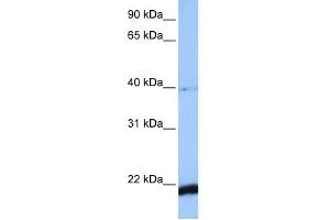 WB Suggested Anti-HBS1L Antibody Titration: 0. (HBS1L 抗体  (C-Term))