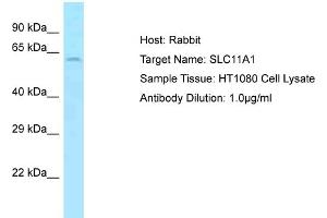 Host: Rabbit Target Name: SLC11A1 Sample Type: HT1080 Whole Cell lysates Antibody Dilution: 1. (SLC11A1 抗体  (Middle Region))