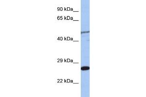 Western Blotting (WB) image for anti-MIS12, MIND Kinetochore Complex Component, Homolog (MIS12) (Middle Region) antibody (ABIN2787627)