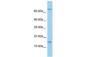 Host: Rabbit Target Name: RPL36AL Sample Type: Hela Whole Cell lysates Antibody Dilution: 1. (RPL36AL 抗体  (C-Term))