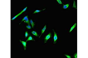 Immunofluorescent analysis of Hela cells using ABIN7146292 at dilution of 1:100 and Alexa Fluor 488-congugated AffiniPure Goat Anti-Rabbit IgG(H+L) (CIB2 抗体  (AA 65-164))