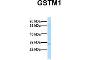 Host:  Rabbit  Target Name:  GSTM1  Sample Tissue:  Human Fetal Lung  Antibody Dilution:  1. (GSTM1 抗体  (N-Term))