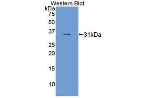 Western Blotting (WB) image for anti-Coagulation Factor XIII, A1 Polypeptide (F13A1) (AA 140-377) antibody (ABIN1867819)