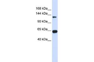 WB Suggested Anti-RGS22 Antibody Titration: 0.