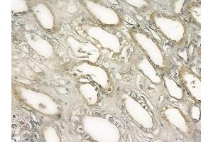 ABIN6261211 and ABIN6273039 at 1/100 staining human normal kidney tissue by IHC-P.