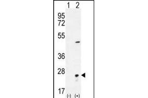 Western blot analysis of VSNL1 (arrow) using rabbit polyclonal VSNL1 Antibody (Center) (ABIN656135 and ABIN2845474). (VSNL1 抗体  (AA 47-75))