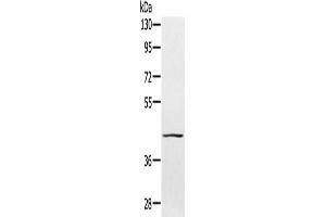 Gel: 8 % SDS-PAGE, Lysate: 40 μg, Lane: 231 cells, Primary antibody: ABIN7130778(PTPN7 Antibody) at dilution 1/300, Secondary antibody: Goat anti rabbit IgG at 1/8000 dilution, Exposure time: 1 minute (PTPN7 抗体)