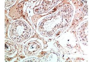 Immunohistochemical analysis of paraffin-embedded human-testis, antibody was diluted at 1:200 (Nanos Homolog 1 抗体  (AA 151-200))